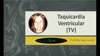 Taquicardia Ventricular TV [upl. by Arol]