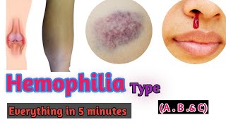 Hemophilia  Hemophilia types  Hemophilia A  Hemophilia B Hemophilia C Doctors goal [upl. by Doersten]