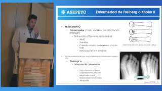 Osteocondritis y osteocondrosis [upl. by Winna]