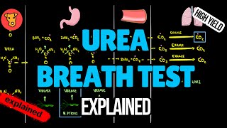 Rapid Urease Test  Rapid Urease test for detecting H Pylori infection  What is Rapid Urease Test [upl. by Ahsitil]