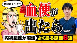 【放置厳禁】便に血が‼︎精密検査は必要？ 痔だと思っていたら大腸がんに 原因別に専門医が解説 教えて萱嶋先生 No313 [upl. by Andriana]