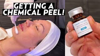 I Got a Chemical Peel My Experience With SkinCeuticals TCA Peel for Hyperpigmentation amp Melasma [upl. by Branch]