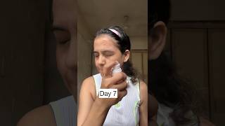 Did Rice Water actually make my skin worse challenge ricewaterchallenge [upl. by Rasla274]