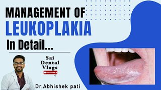 MANAGEMENT OF LEUKOPLAKIA IN DETAIL [upl. by Niac]