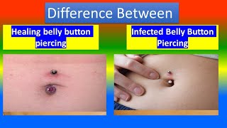 Distinction between Healing belly button piercing and Infected Belly Button Piercing [upl. by Quintin978]