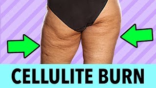 28 Day Cellulite Burn Challenge  Get Rid Of Cellulite On Thighs And Bum Fast [upl. by Nnaharas379]