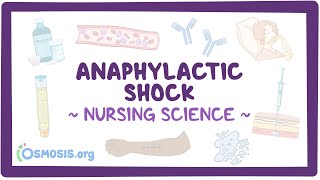 Anaphylactic shock Clinical Nursing Care [upl. by Idolla248]