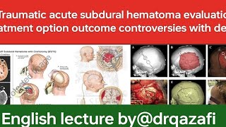 Traumatic acute subdural hematomaEnglish lecture evaluation treatment option outcome controversies [upl. by Anila928]