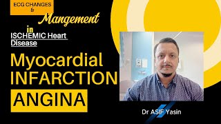 Ischemic heart disease  MI  NSTEMI  Angina  ECG  ‫ڈاکٹر آصف یاسین‬  mbbs NEB plab PMDC [upl. by Kristie]