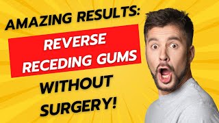 How To Reverse Receding Gums WITHOUT Surgery [upl. by Eniarral]