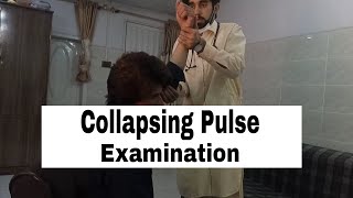 Collapsing Pulse Clinical ExaminationCausesPathologyvascular [upl. by Loretta]