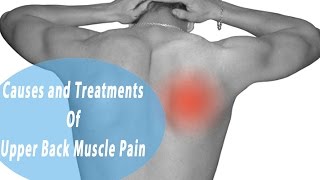 Upper Back Muscle Pain  Common Causes and Treatments Of Upper Back Muscle Pain [upl. by Janella]