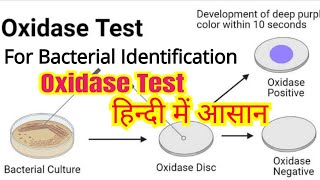 Oxidase test in hindi  Bacterial identification  Microbiology [upl. by Felicio]