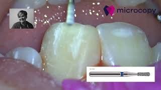 Tip for Micromorphology [upl. by Jotham]