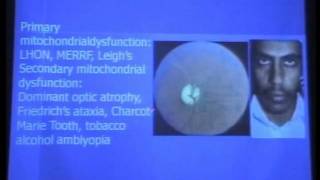 Hereditary and toxic nutritional optic neuropathies [upl. by Rekrap984]