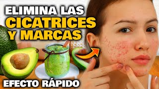 Elimina TODAS las CICATRICES y MARCAS de tu Rostro y tu Piel  Mascarilla y Crema Facial Casera [upl. by Neela]