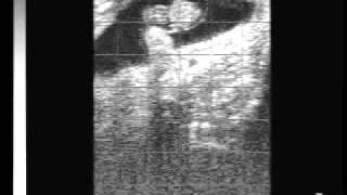 Bovine pregnancy 40 days with EasiScan ultrasoundwmv [upl. by Esyle109]