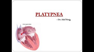 Platypnea Dr Akif Baig [upl. by Kelbee]