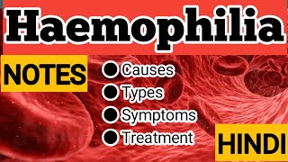 Haemophilia  Haemophilia A amp Haemophilia B  Causes  Symptoms  Treatment  Explanation with notes [upl. by Miguela541]