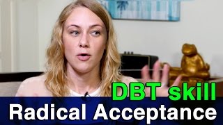 DBT Skill Radical Acceptance [upl. by Nallak]