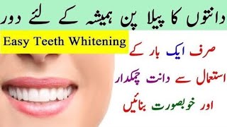 How to Whiten Your Teeth Naturally  Teeth Whitening Home Remedy  Teeth Whitening [upl. by Yrailih]