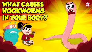 What causes Hookworm। Intestinal Worms Symptoms and Treatment  Worm Infection  Dr Binocs Show [upl. by Aynatan]