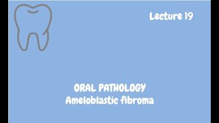 Ameloblastic fibroma Complete Lecture  For NBDE NDEB MDS amp FCPS [upl. by Fulbright]