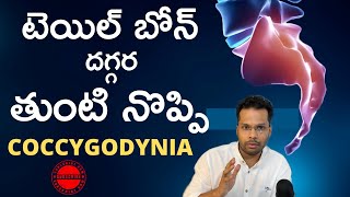 Tail bone Hip pain  Coccydynia  Dr Ramprasad Kancherla [upl. by Aiblis]