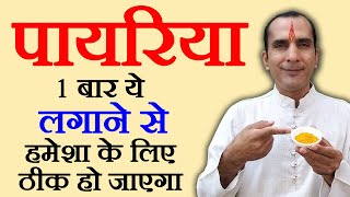 पायरिया जड़ से ठीक करने का घरेलु उपाय  payriya ka ilaj  Pyorrhea Treatment in Hindi [upl. by Lorens745]