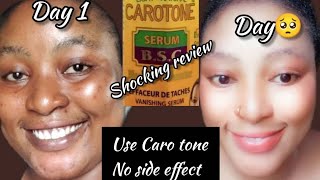 CAROTONE Serum  Shocking 😲 ReviewBrightening 🧖‍♀️Repair Soothing Oilcarotoneserum Review [upl. by Eneli]