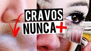 COMO TIRAR CRAVOS EM 1 MINUTO SEM DOR RÁPIDO E FÁCIL  BrunaTV [upl. by Nicko]