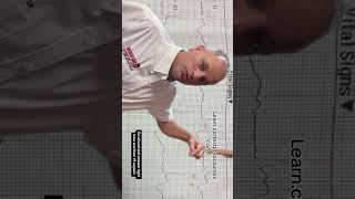 Transcutaneous pacing quiz ACLS aclstestprepcourse ACLSstudyguide ACLSreview aclsexam [upl. by Sillek]