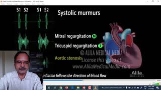 Lecture 13 Hearts Sounds Phonocardiography [upl. by Ib]