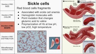 Red Blood Cell Morphological Abnormalities [upl. by Agnot]