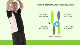 Posture  Correcting Posterior Pelvic Tilt [upl. by Myca506]