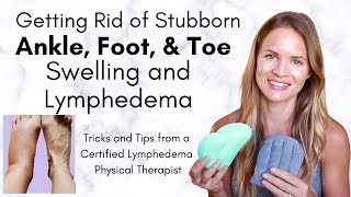 Toe Foot and Ankle Lymphedema and Swelling  Tricks to get Rid of Stubborn Lymphedema [upl. by Attenaz]