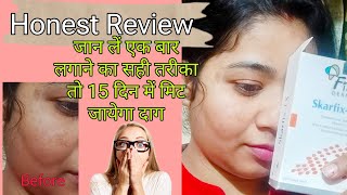 Honest Review of FixDerma Pigmentation Cream FixDerma ki skarfix Cream ka istemal Pigmentation [upl. by Hedges242]