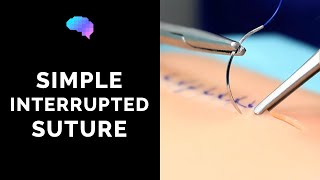 Simple interrupted suture wound suturing  OSCE Guide  UKMLA  CPSA [upl. by Patin]