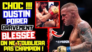 ⚠️CHOC JUSTINE POIRIER GRAVEMENT BLESSÉE Après Son COMBAT Contre ISLAM MAKHACHEV 😱 [upl. by Fregger]