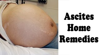 Ascites Treatment  How To Cure Ascites  Home Remedy for Ascites  ekunji [upl. by Adyaj]