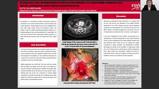 ESVS 35th Annual Meeting 2021 Eposter Presentation [upl. by Kozloski863]