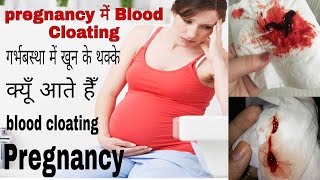 Blood Clots During Pregnancy  Pregnancy me Blood ka Thakka Aana  Womens Information [upl. by Gyimah]