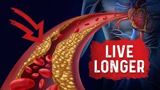 Bad Cholesterol Can Make You Live Longer  Dr Berg [upl. by Roleat629]