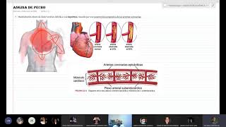 Clase angina de pecho e infarto Fisiopatología [upl. by Meit]