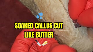 SOAKED CALLUS CUT LIKE BUTTER [upl. by Fisoi82]