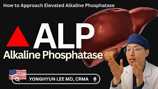 How to Approach Elevated Alkaline Phosphatase ALP [upl. by Agostino]