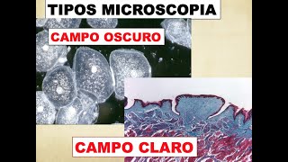 TIPOS DE MICROSCOPIA  CAMPO CLARO Y CAMPO OSCURO [upl. by Sitra937]