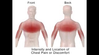 Distinguishing Types of Chest Pain [upl. by Lilas]