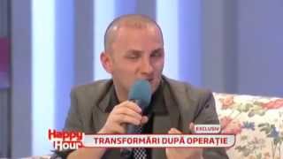 Mihai Traistariu  implant de par  partea a IIIa din 3   la 6 zile dupa operatie [upl. by Aloisius140]