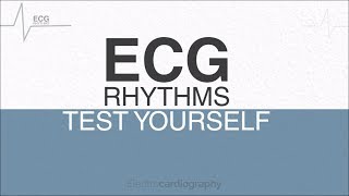 ECG Rhythms for selfassessment Test ECG Interpretation Skills [upl. by Sudderth]